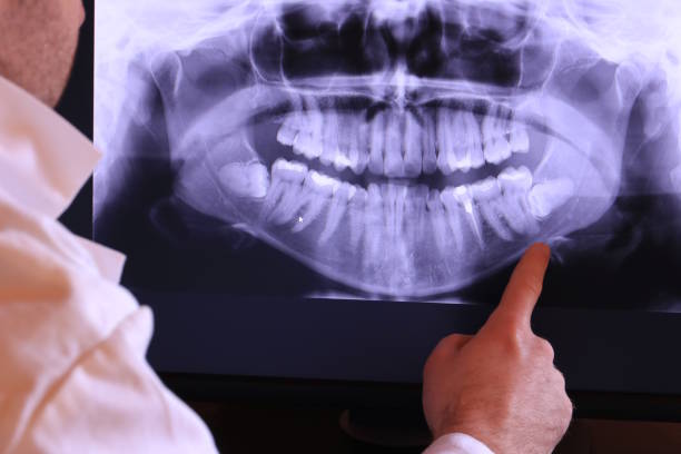 Best Teeth Whitening  in Morrice, MI